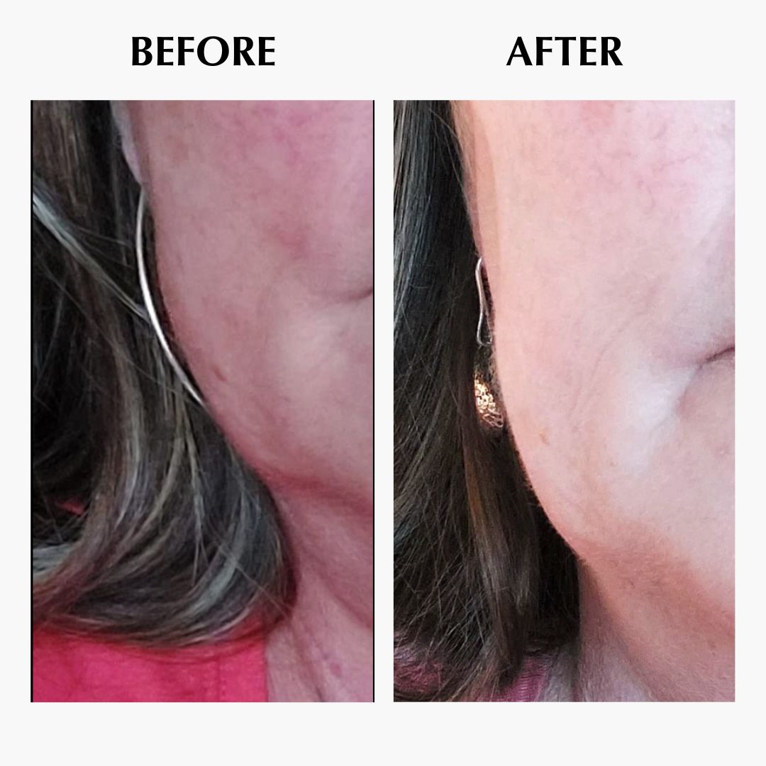 The Velvie Face Sculpting Device (5 - in - 1) - Velvie.